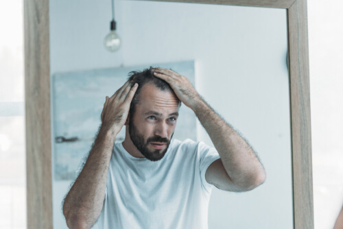Can Hereditary Hair Loss be Prevented in Men