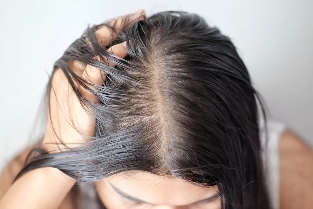 How to Prevent Oily Hair 